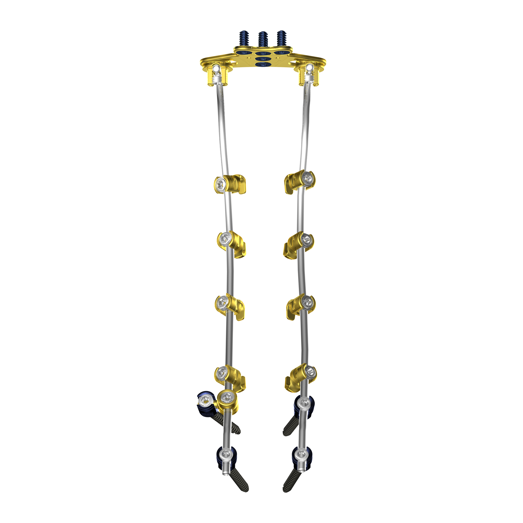 Centrafix Midline Fixation System