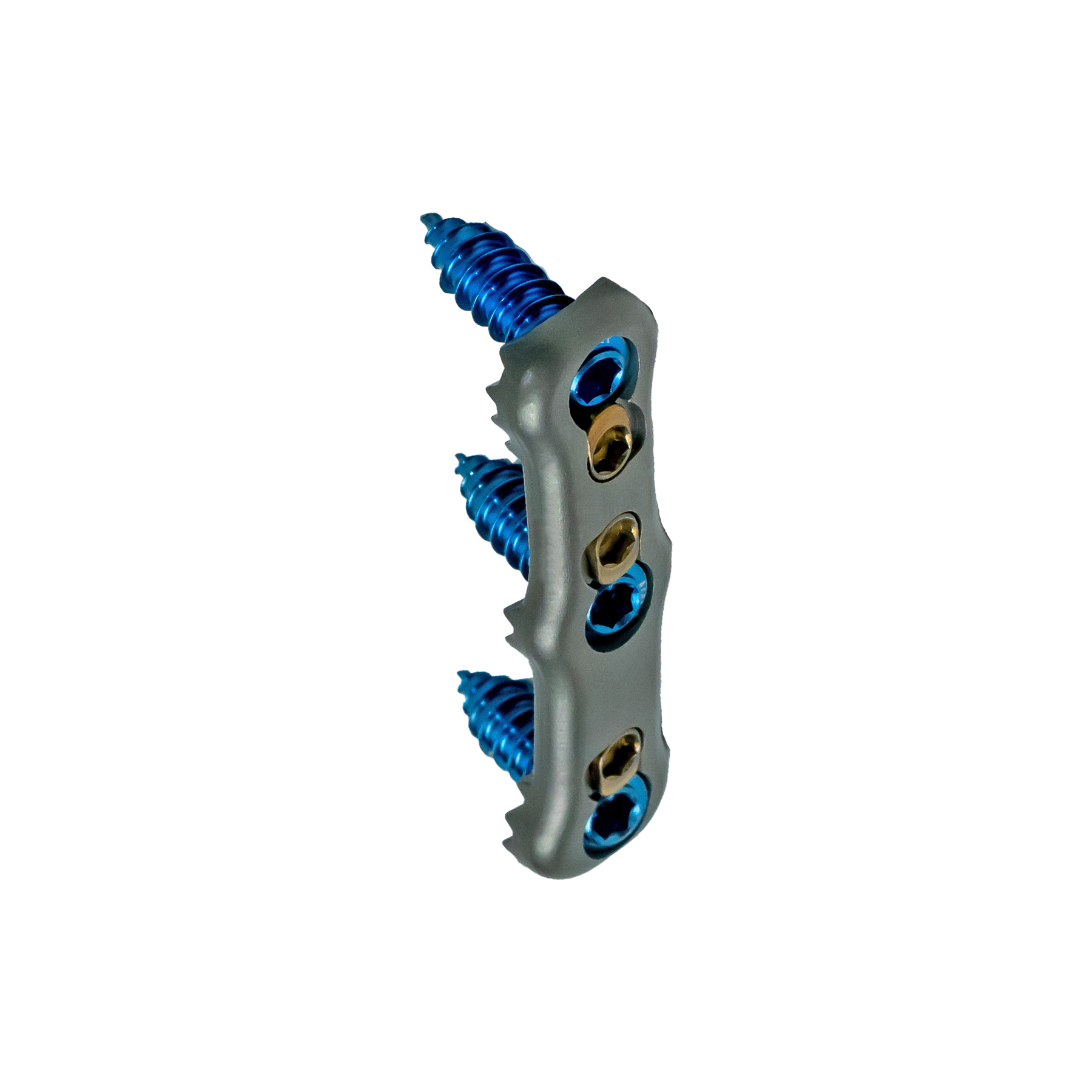 Anodyne Anterior Cervical Plate System