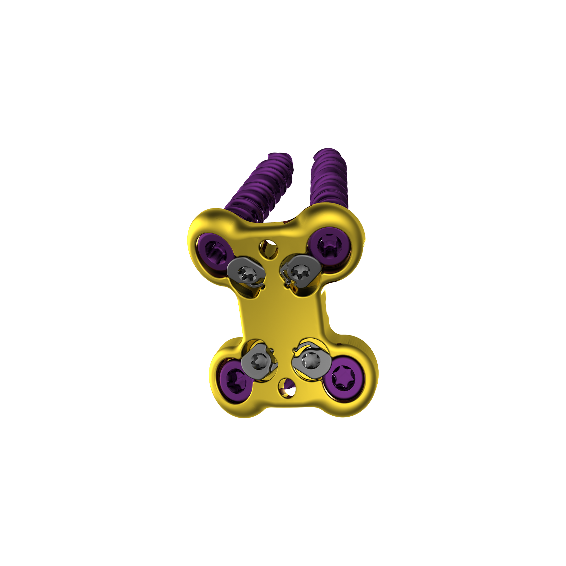 CL5 ALIF Interbody System