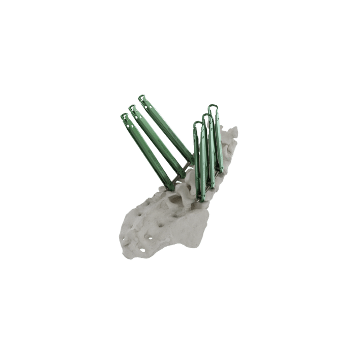 Thunderbolt ExTab Minimally Invasive Extended Tab Pedicle Screw System